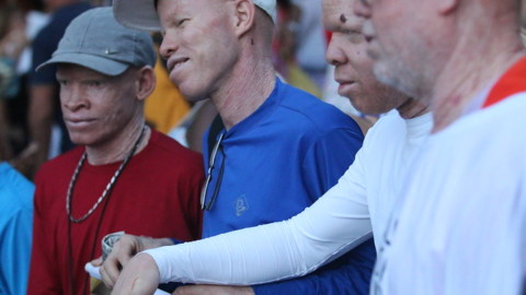 Ativistas albinos na Marcha de Abertura do FSM